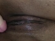 Freckled pussy play 1/16