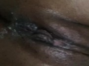 Freckled pussy play 14/16