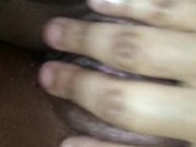 Freckled pussy play 16/16