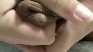 Foreskin cum