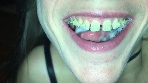 Cum play with retainer.