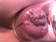 anal pump - Screenshot 10 of 16 - Straight