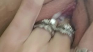 Teaser
