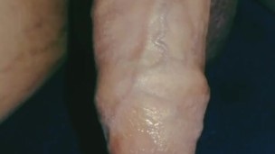 Korean flaccid uncircumcised foreskin lotion injection syringe fetish clip