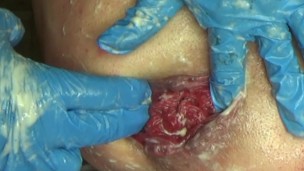 Prostate cumshot (массаж простаты) Gape Prolapse