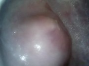 Filmed the vagina from the inside 13/16
