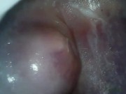 Filmed the vagina from the inside 14/16