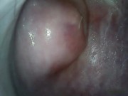 Filmed the vagina from the inside 15/16
