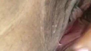 Pussy hair