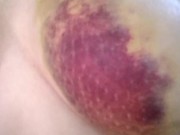 After Car Accident (2016) - Screenshot 13 of 16 - Big Boobs