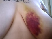 After Car Accident (2016) - Screenshot 14 of 16 - Kink