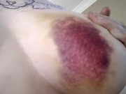 After Car Accident (2016) - Screenshot 2 of 16 - Butt