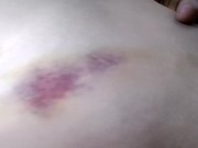 After Car Accident (2016) - Screenshot 4 of 16 - Kink