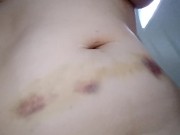 After Car Accident (2016) - Screenshot 8 of 16 - Big Boobs