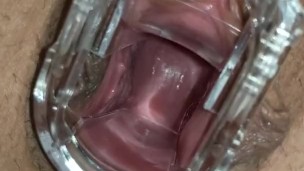 speculum insertion - medical insertion - milf