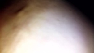 Nipples