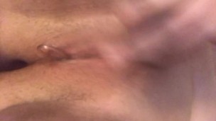 Both holes filled