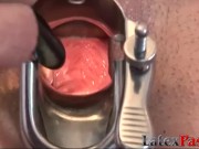 Lady gets her pussy spread and creampied by the doctor 8/16