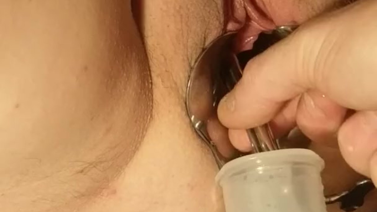 Female Medical Play - Speculum Stretched Pussy Urethral Peehole Stretching - Free Sex Video - RedTube