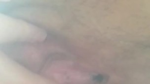 Tight hole needs treatment