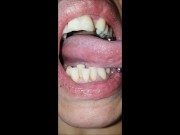 Mouth and tongue check dry - demo