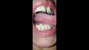 Mouth and tongue check dry - demo