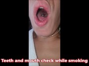 Mouths, tongues and teeth of August