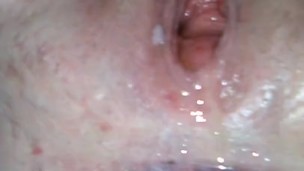 Ruined Destroyed GAPING Fatass BBW Cunt and Asshole Seen Pissing