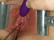 Female Urethral Sounding Orgasm Stretched & Clamped Pussy S&M Medical Play 14/16