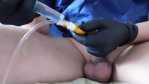Ending insertion 26Fr Foley Catheter