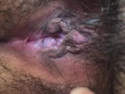 Close up pee into jar. see everyhting