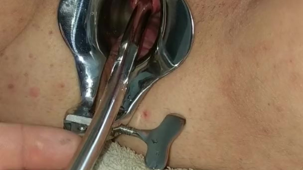 Piss Re-injection - Female Urethral Sounding - BDSM Stretched Wide Peehole - RedTube