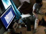 Request Of Me Putting On Prosthetics