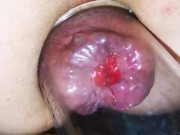 Anal pump and rosebud