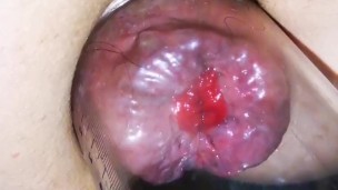 Anal pump and rosebud