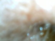 Looking Inside a Dirty Ear