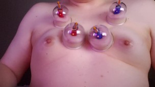 Short Breast Cupping - Trans Woman