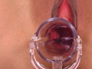 【無】マンコ図鑑 豊田ゆう パート1 12/16