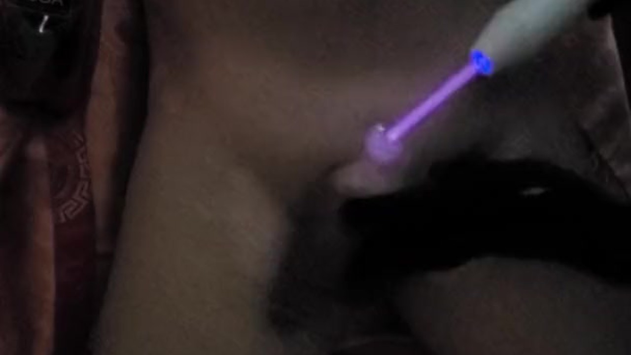 PENIS COCK DICK High Frequency treatment massage - Free Sex Video - RedTube