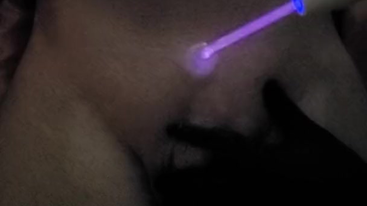 PENIS COCK DICK High Frequency treatment massage - Free Sex Video - RedTube