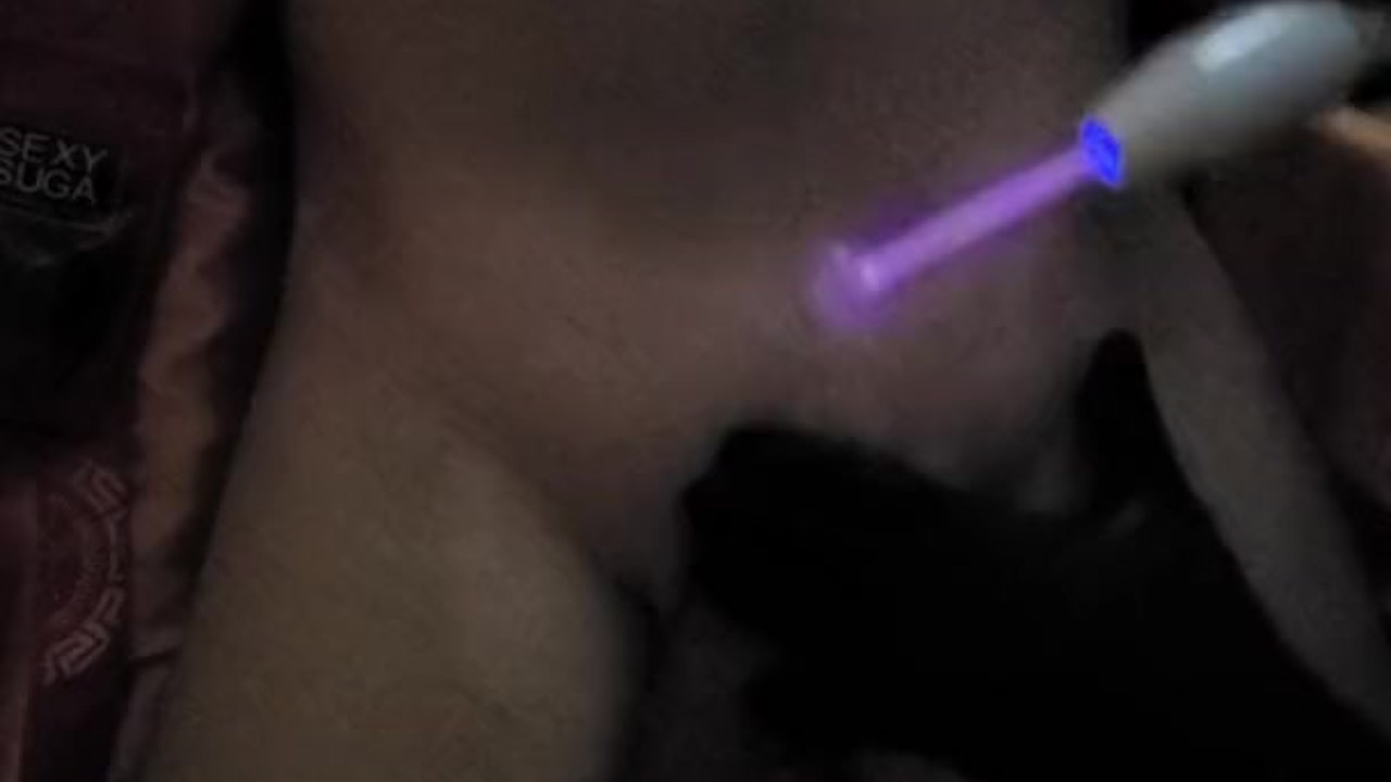 PENIS COCK DICK High Frequency treatment massage - Free Sex Video - RedTube
