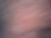 アナル内部　内視鏡　クスコ　直腸 10/16