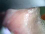 アナル内部　内視鏡　クスコ　直腸 14/16