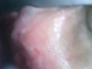 アナル内部　内視鏡　クスコ　直腸 15/16