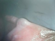 アナル内部　内視鏡　クスコ　直腸 2/16