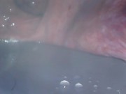 アナル内部　内視鏡　クスコ　直腸 5/16