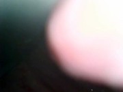 アナル内部　内視鏡　クスコ　直腸 9/16