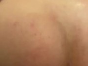 Up close freedom pegging 14/16