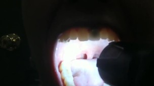 Tongue and Throat Exam (with and without flashlight)