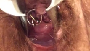 Speculum removal push, see deep inside mature MILF BBW gynecology medical 